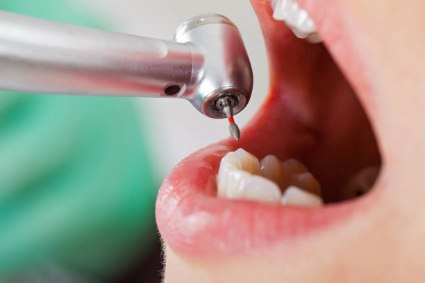 Best Root Canal Emergency Dentist  in Twin Grove, IL